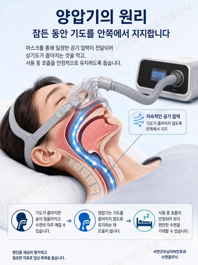 마스크에서 코와 인두를 지나 상기도로 공기 압력이 전달되는 해부학적 설명 장면