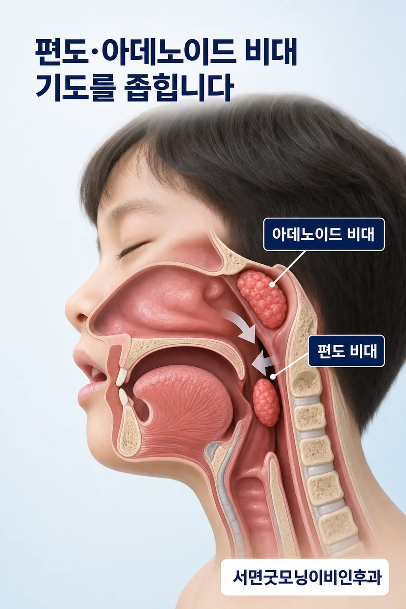 수면 중 호흡 장애를 겪는 아이