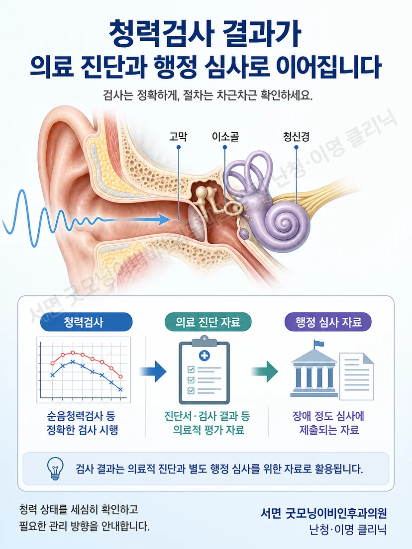 청력검사 결과가 의료적 판단과 행정 심사 자료로 연결되는 개념도