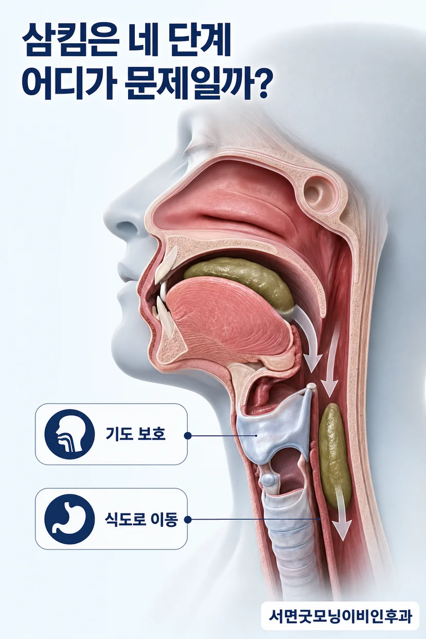 연하곤란 증상 예시