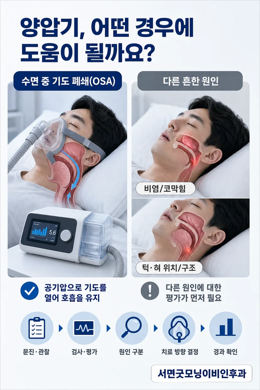 수면 중 기도 폐쇄 모식도