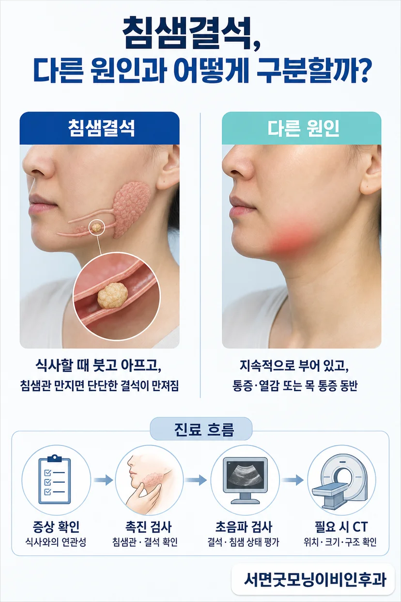 침샘 부종과 통증