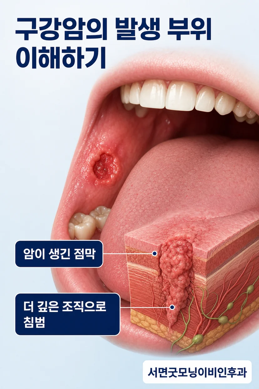 입안 덩이와 점막 변화