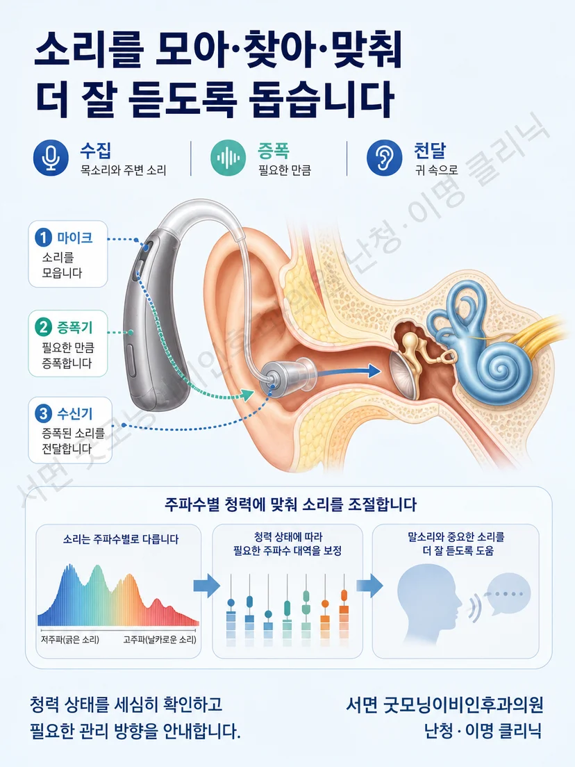 마이크와 증폭 처리 및 수신기로 구성된 보청기 작동 원리