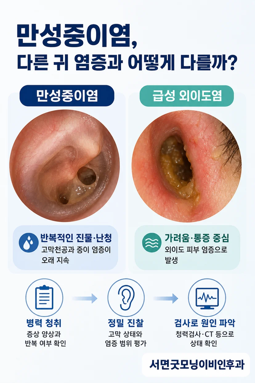 청력검사