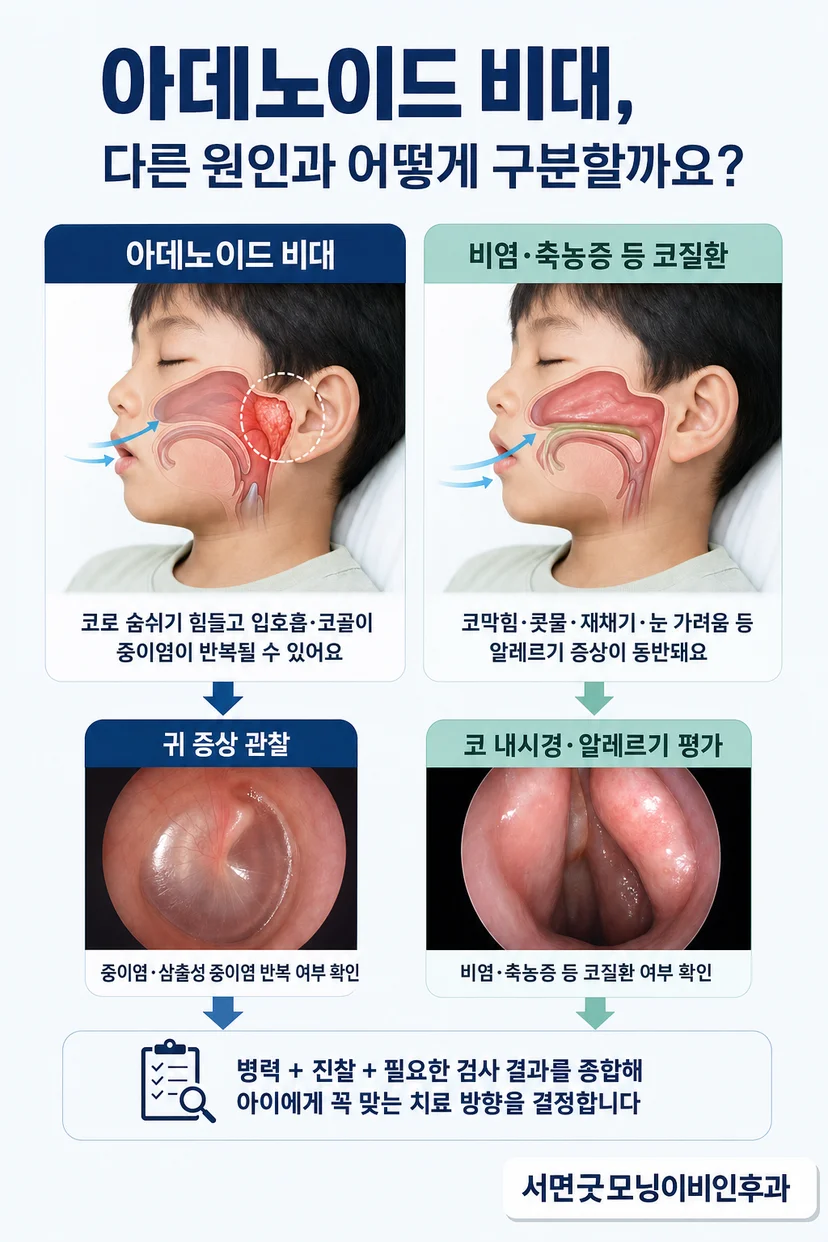 비강 내시경 검사 장면