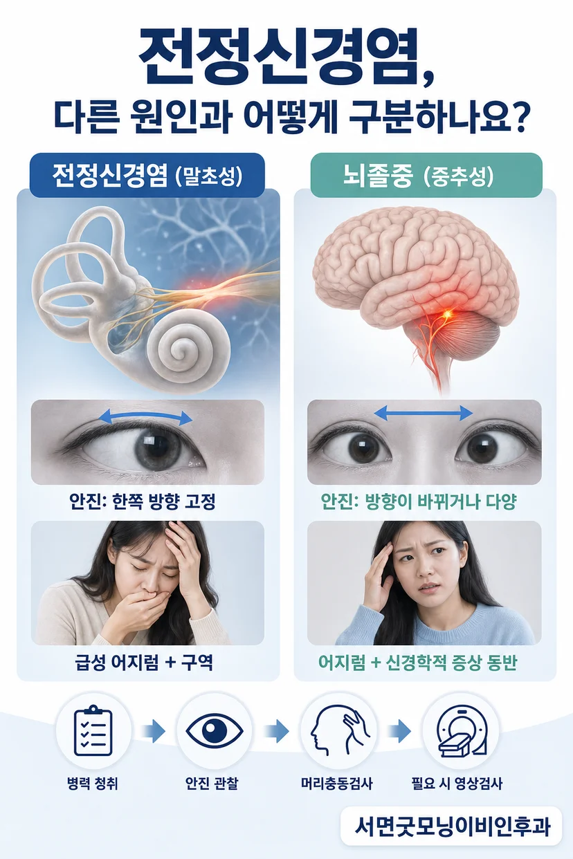 뇌졸중 감별을 위한 신경학적 평가