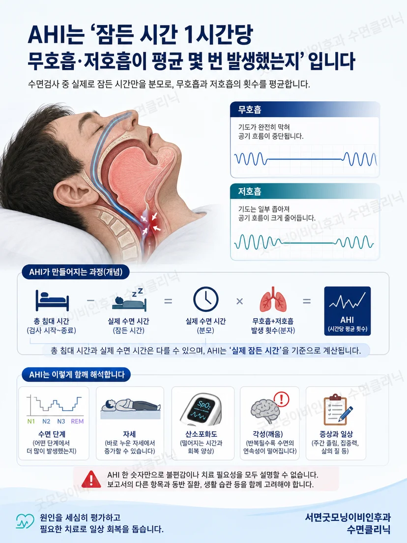 침대에 누운 전체 시간과 뇌파로 확인한 실제 수면 구간을 나누어 표시한 도식