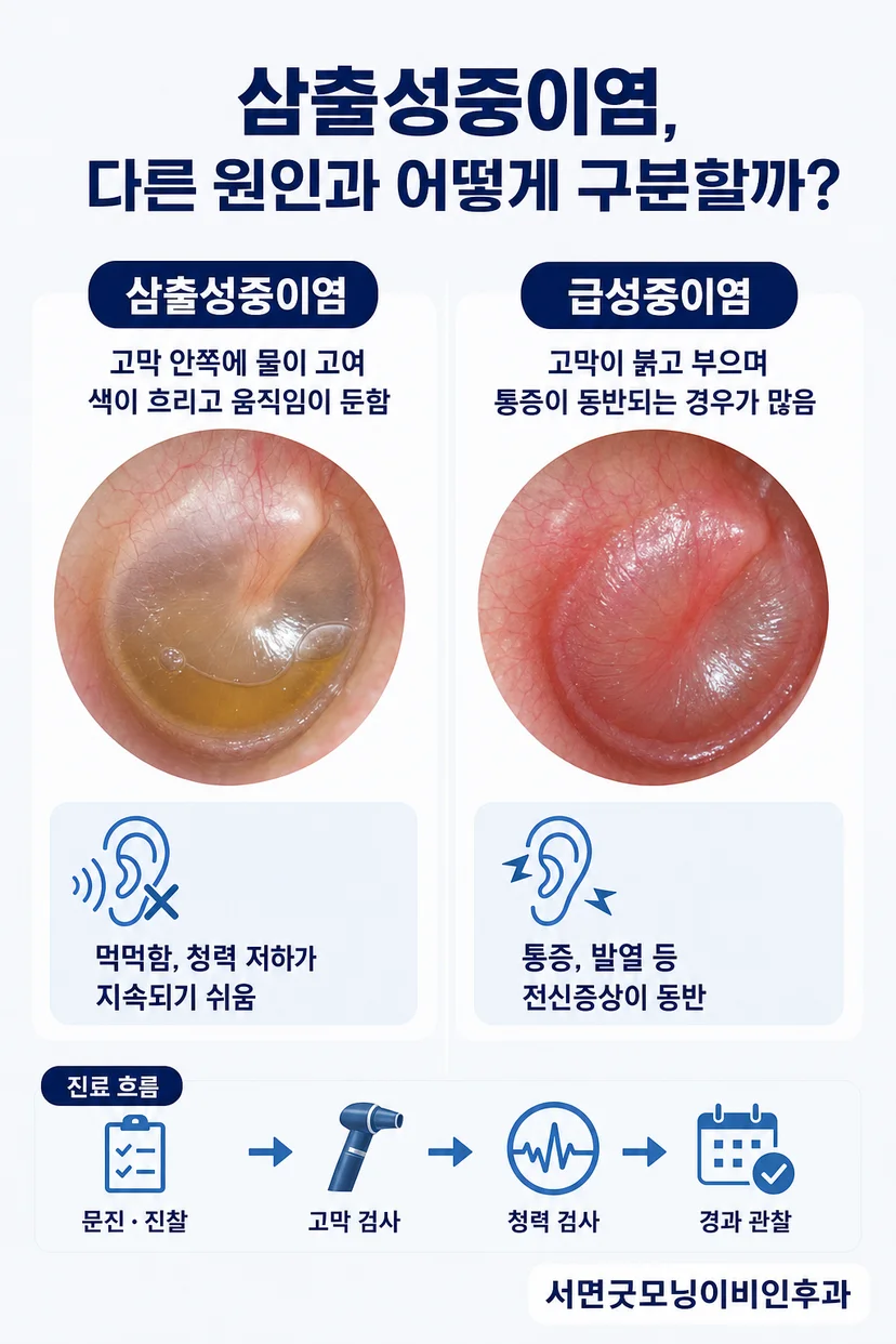 이관기능장애와 중이염의 차이