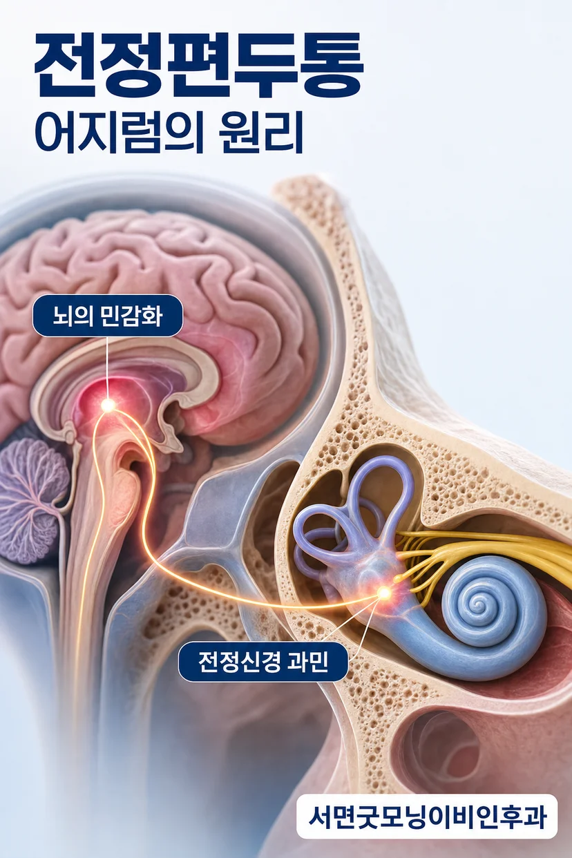 전정편두통의 증상 이미지