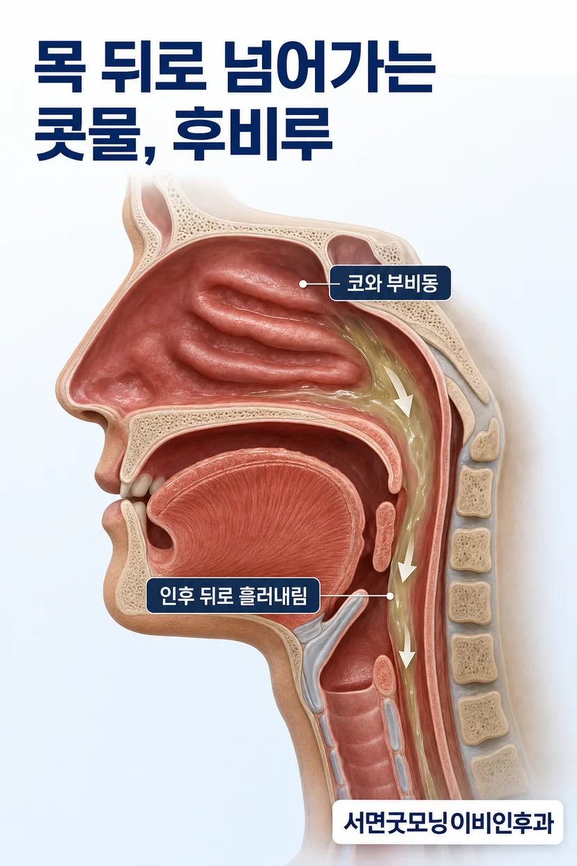 후비루 증상과 관련된 목 부위 일러스트