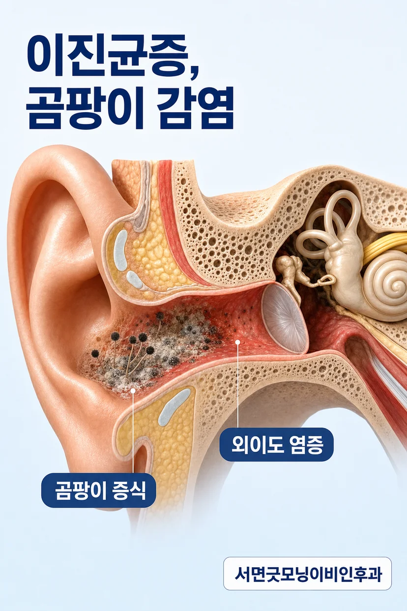 이진균증에서 보이는 다양한 분비물