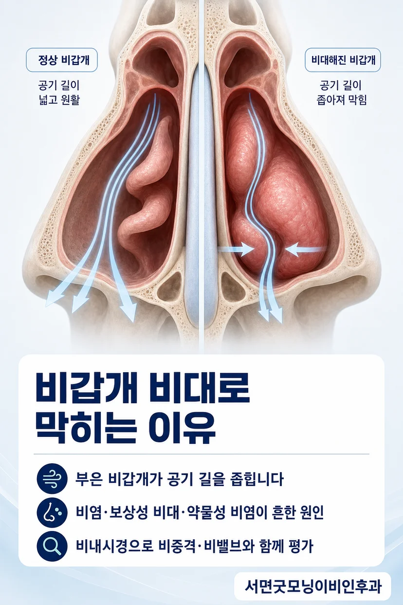 이비인후과 전문의 의료진 사진