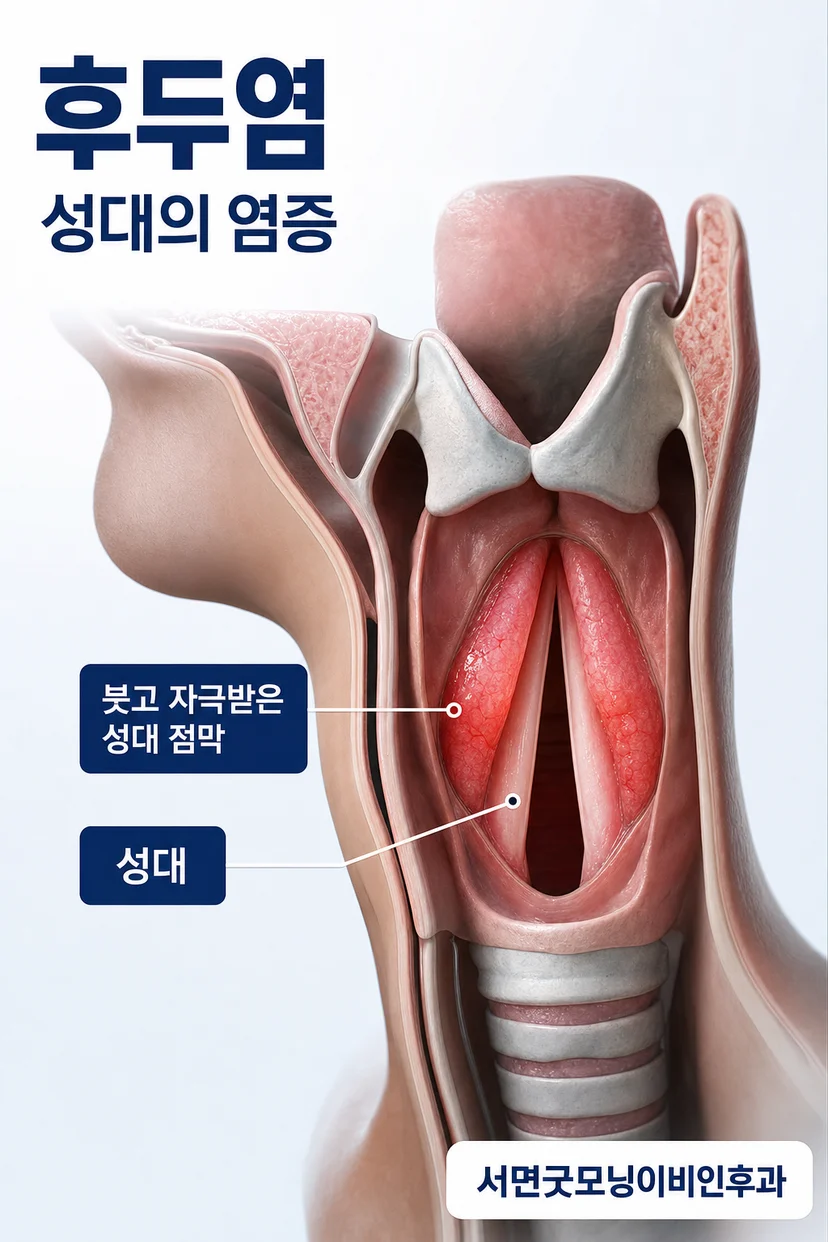 쉰목소리와 후두염 증상