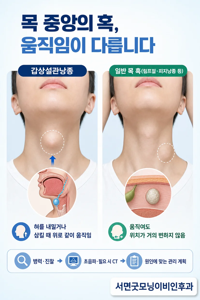 CT로 본 갑상설관낭종의 위치 확인