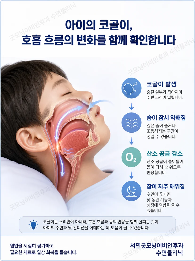아이의 코와 입 뒤쪽 인두를 옆면으로 보여 주는 상기도 해부 그림