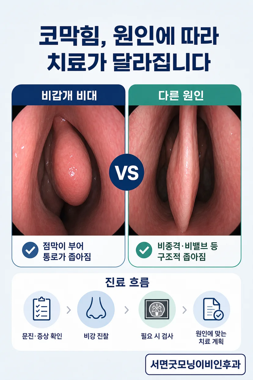 코막힘과 관련된 증상을 나타내는 이미지