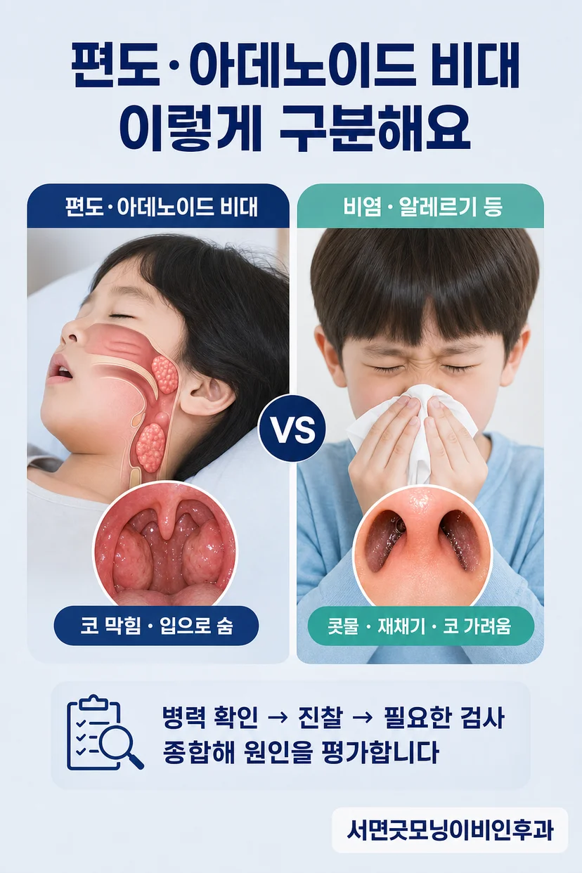 이비인후과 내시경 검사 모습