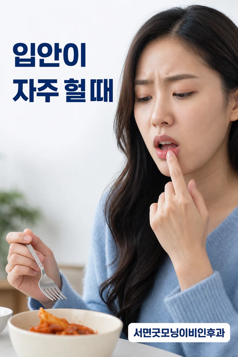 입안 점막에 발생한 구강궤양 사진