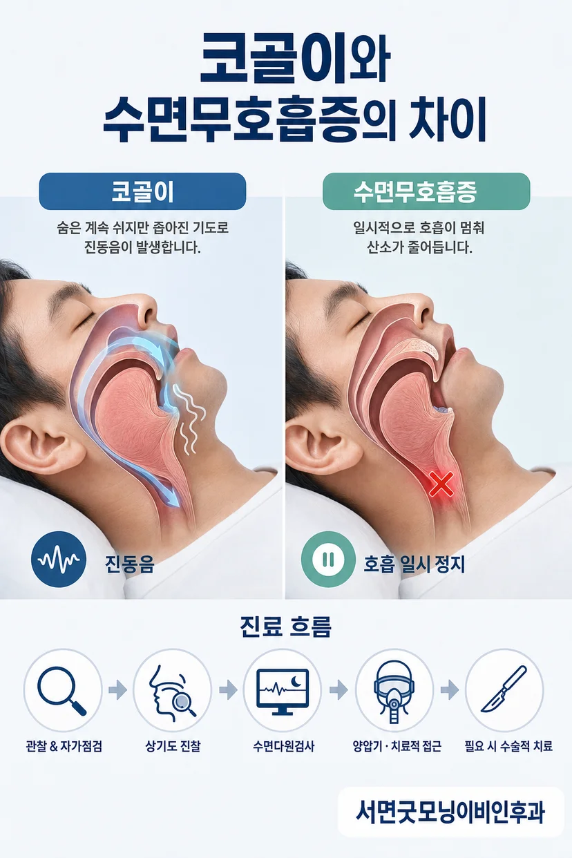수면다원검사 장비