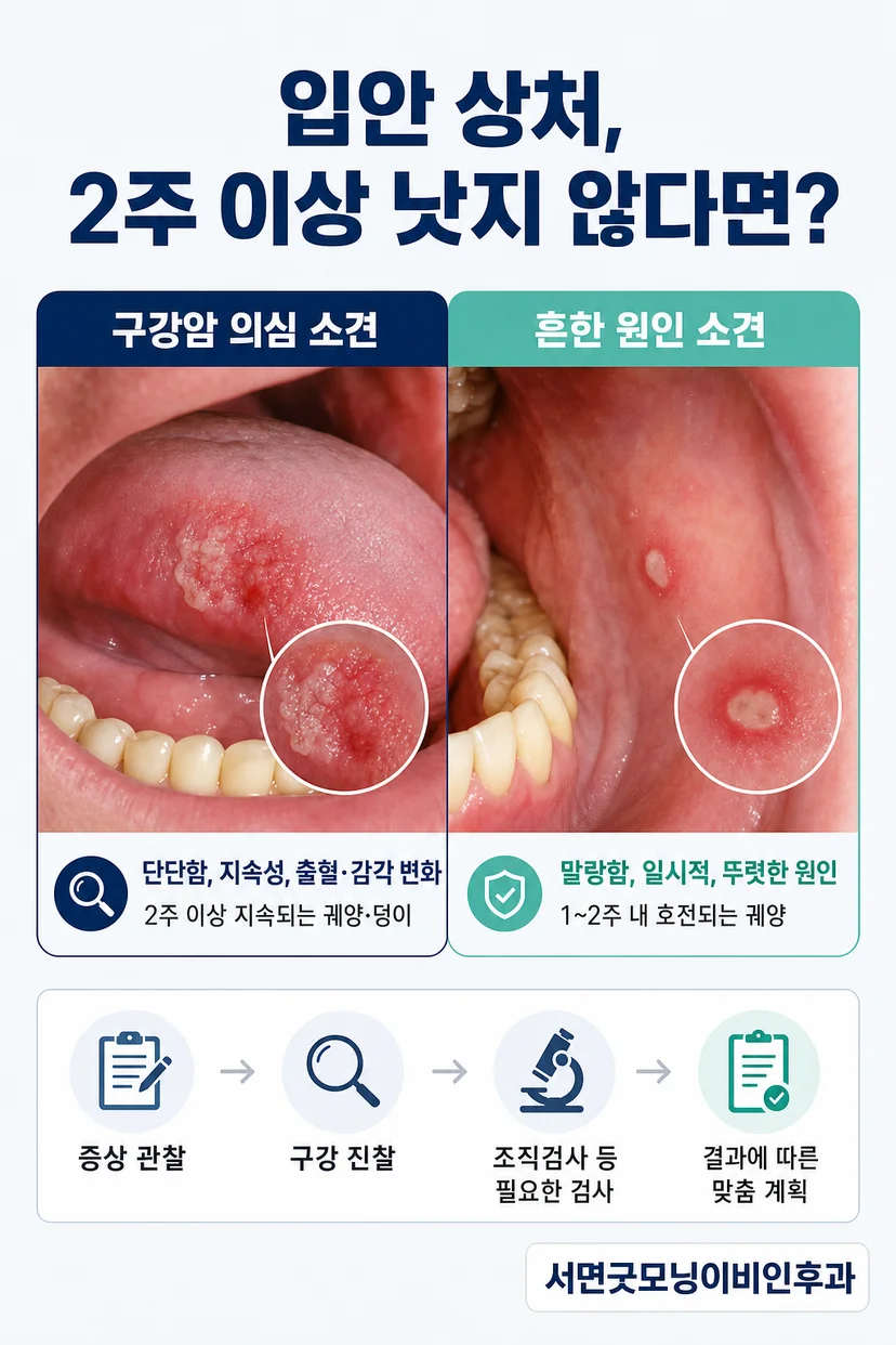 구강암 조직검사 과정
