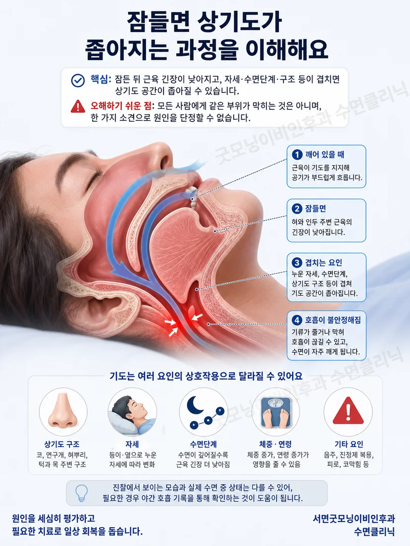 코와 연구개, 구인두, 혀뿌리가 표시된 옆면 상기도 해부 그림