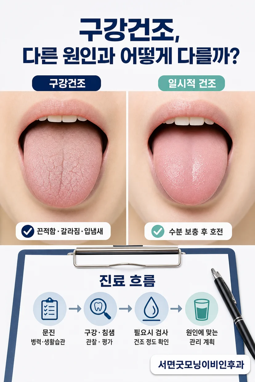 구강건조 감별 질환