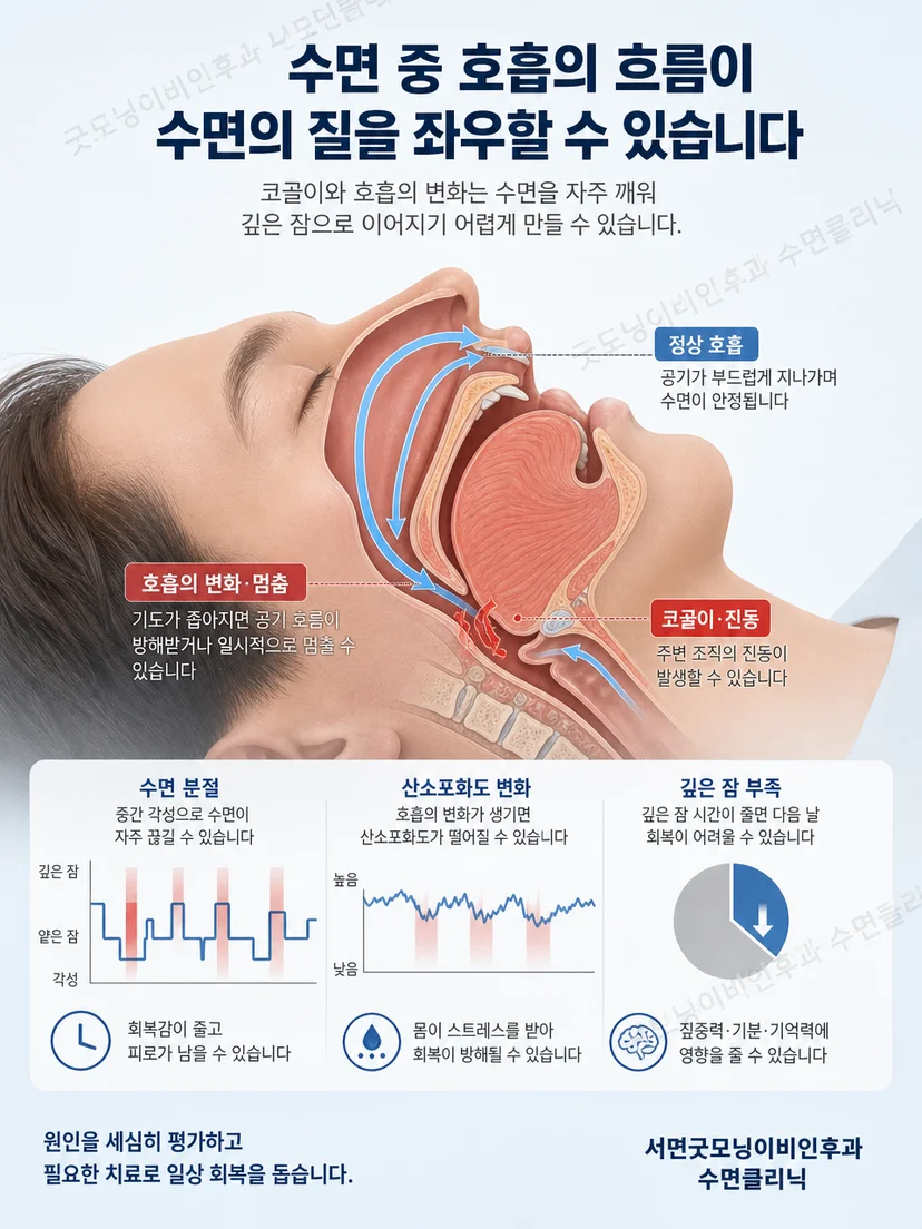 수면 중 각성 요인으로 호흡 변화와 다리 움직임이 표시된 침대 삽화