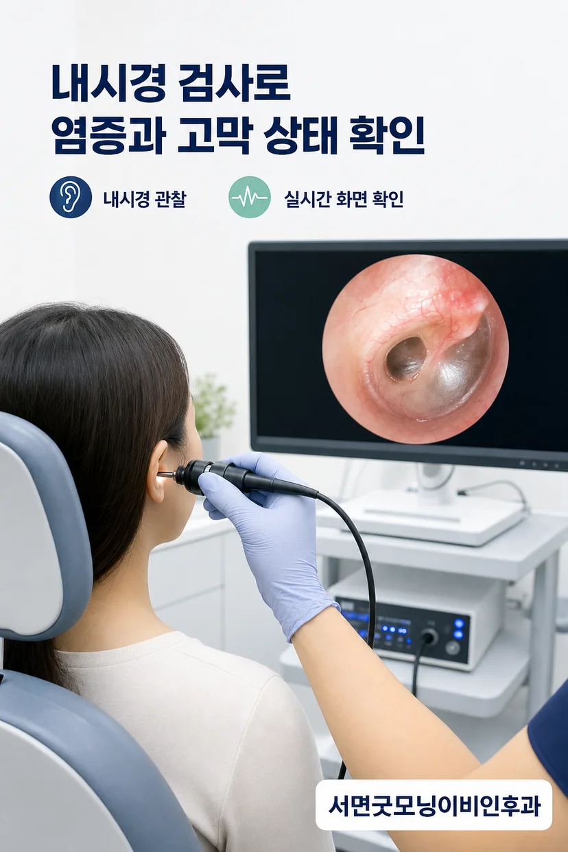 고막성형술 설명