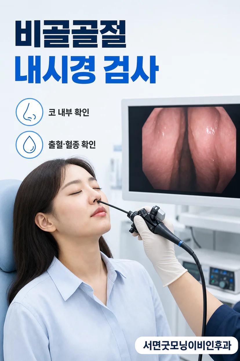 코뼈 X-ray 검사 예시