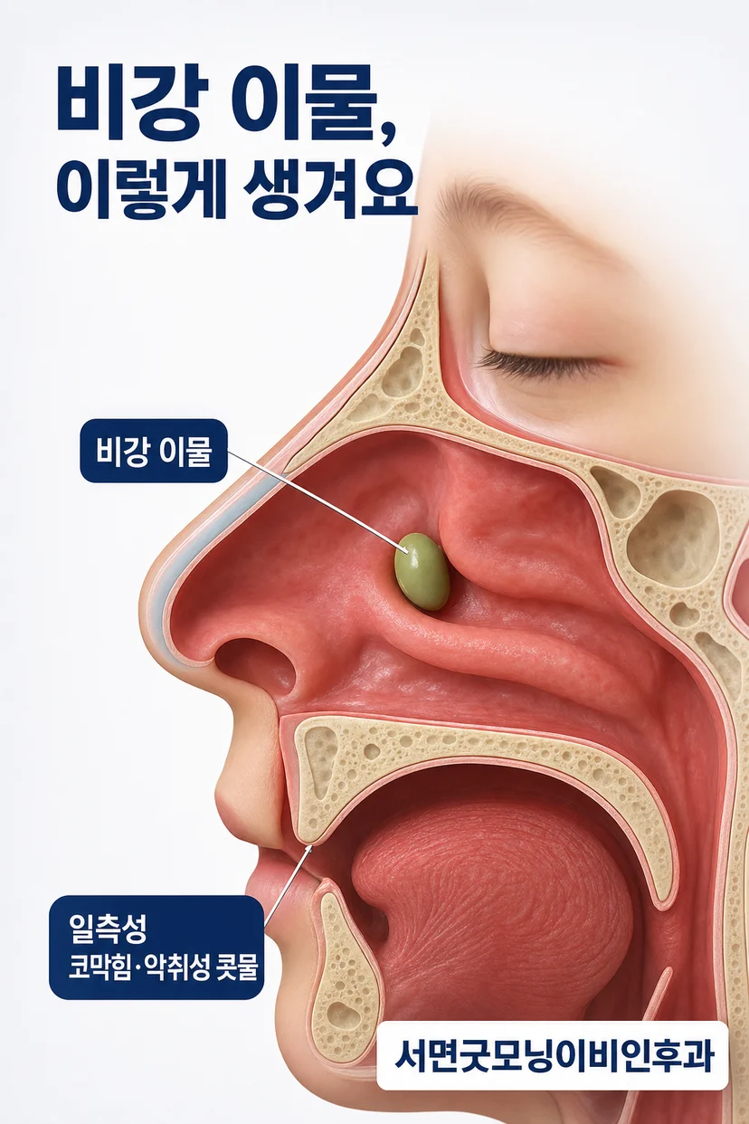 비강 이물로 인한 콧물과 코막힘