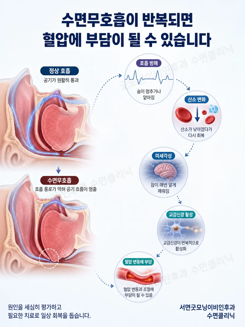 수면 중 좁아진 목 기도와 산소 변화 및 교감신경 반응을 연결한 해부 그림