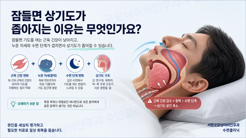 깨어 있을 때와 잠든 뒤의 혀와 연구개 위치를 비교한 상기도 단면