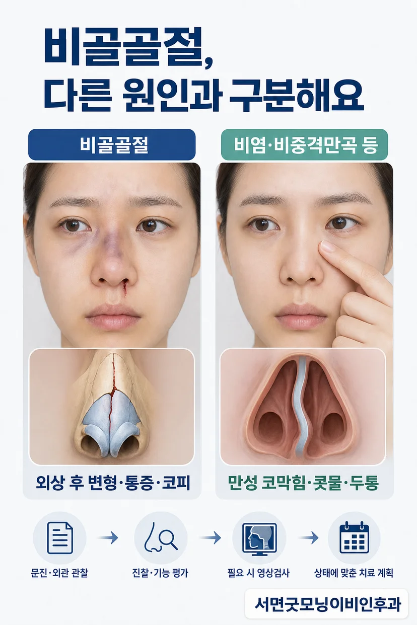 비중격혈종의 임상 사진