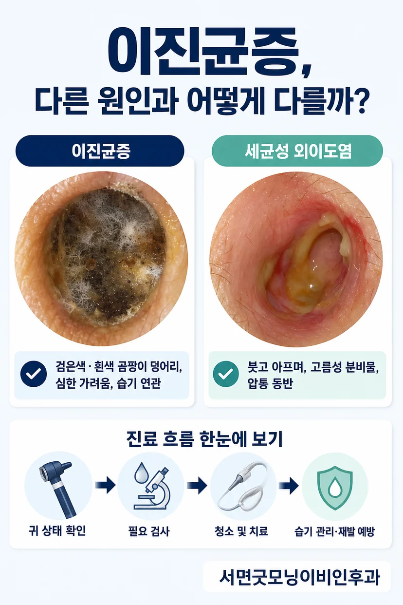 이경 또는 내시경으로 귀를 진찰하는 모습