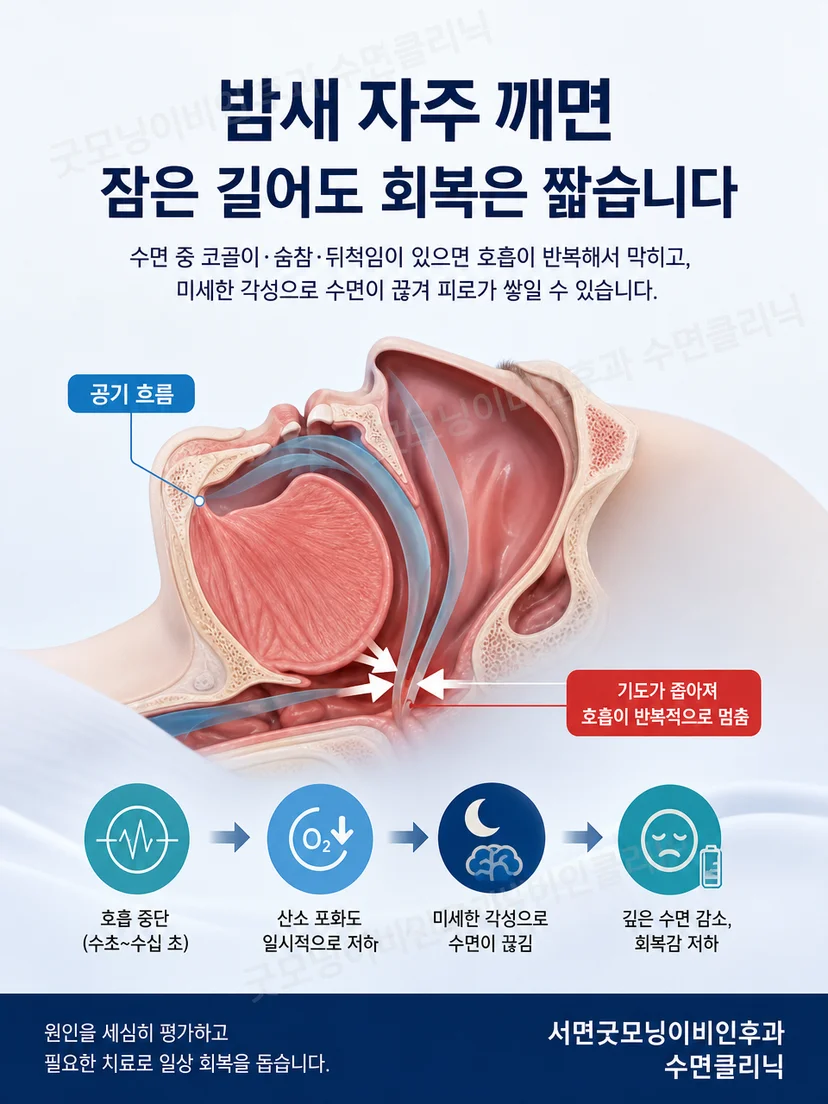 수면의 연속성과 야간 각성을 설명하는 도식