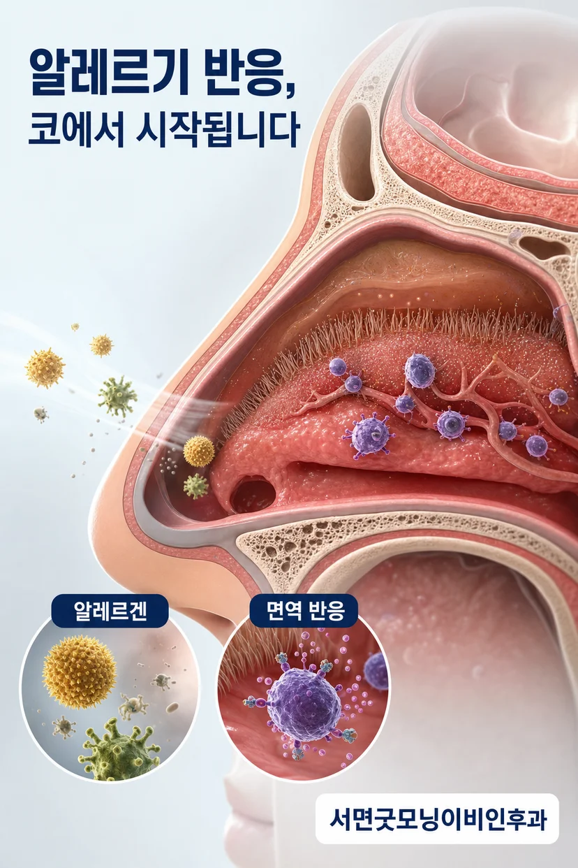 알레르기 증상 설명