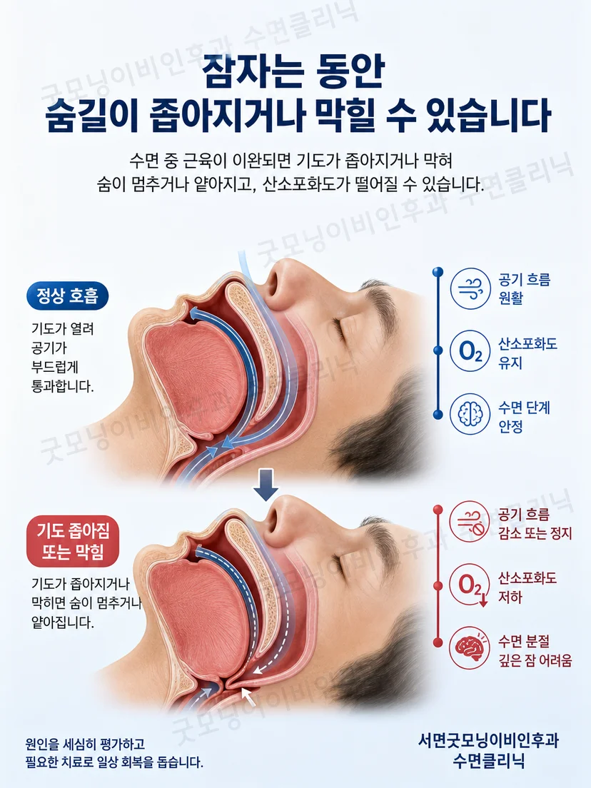 머리의 뇌파 전극과 눈 옆 전극, 턱 근육 센서 위치를 보여주는 설명 장면