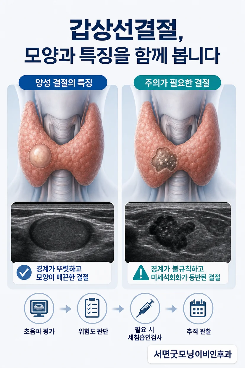세침흡인검사(FNA) 장면