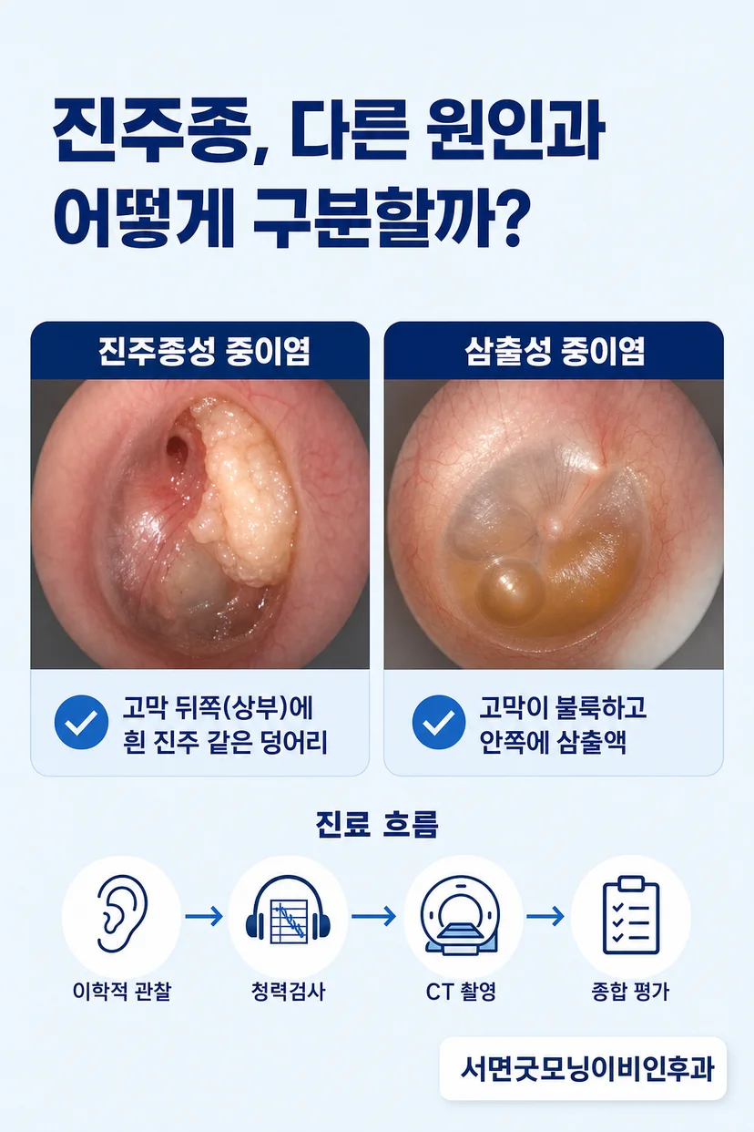 중이 CT 검사