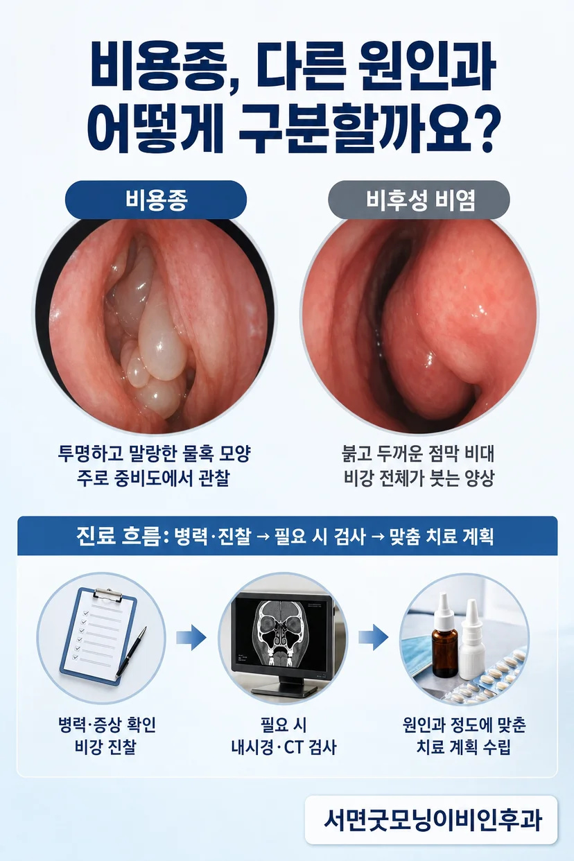 비용종 수술 장면
