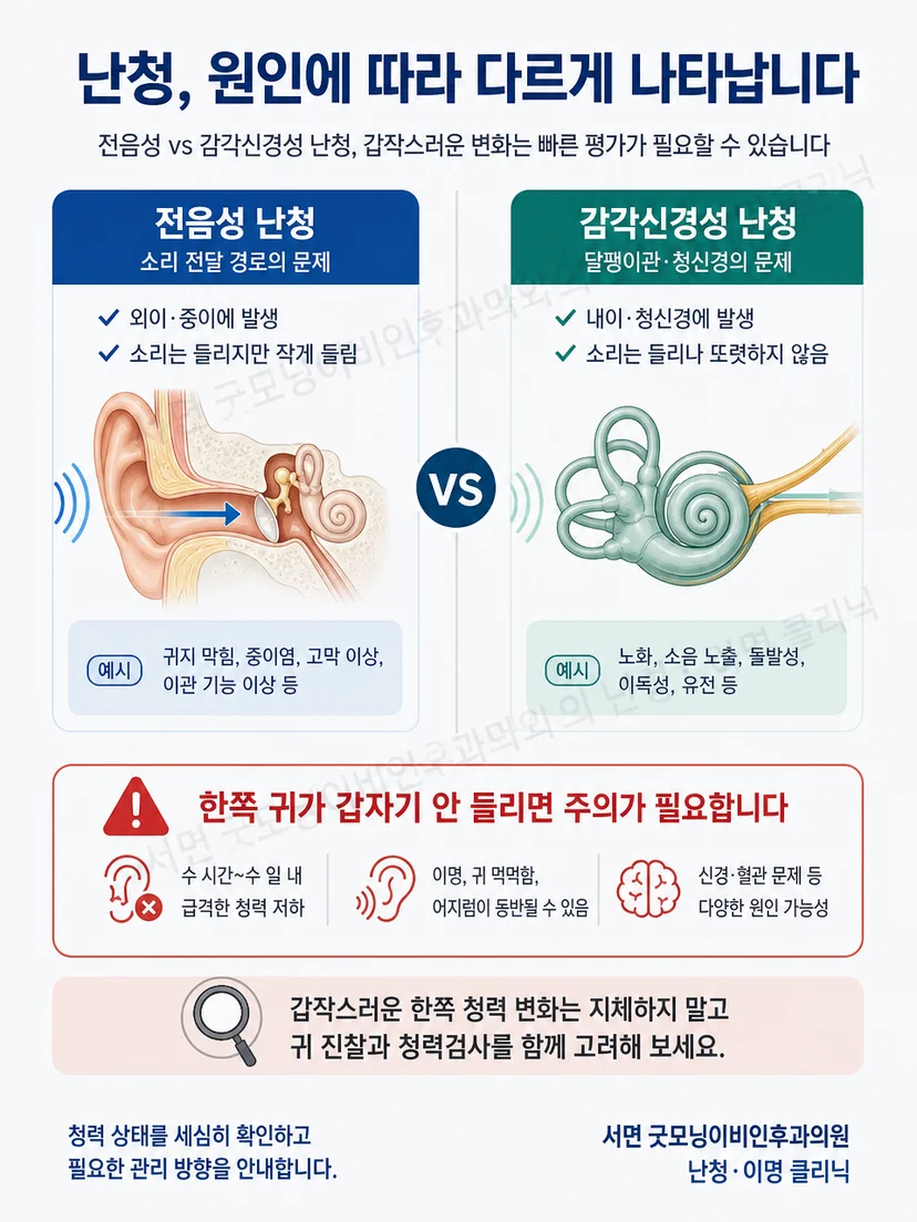 전음성 난청과 감각신경성 난청 및 갑작스러운 청력 변화의 주의점을 비교한 그림