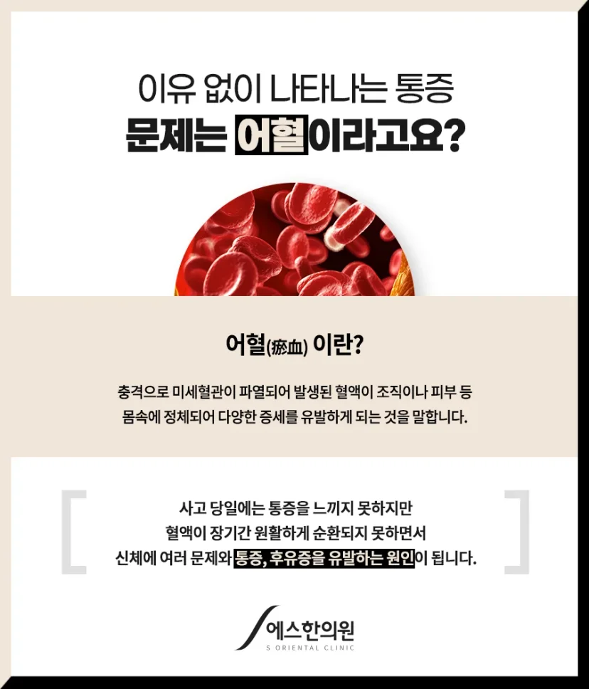 당정동 허리 통증 한의원|어혈의 정의와 통증 유발 원인 설명 카드뉴스