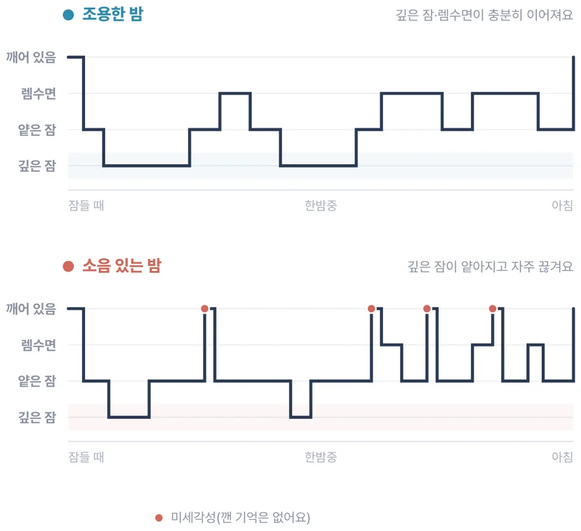 조용한 밤과 소음 있는 밤의 깊은 잠·렘수면 비율과 미세각성 차이를 계단식으로 보여주는 수면 구조 비교 히프노그램