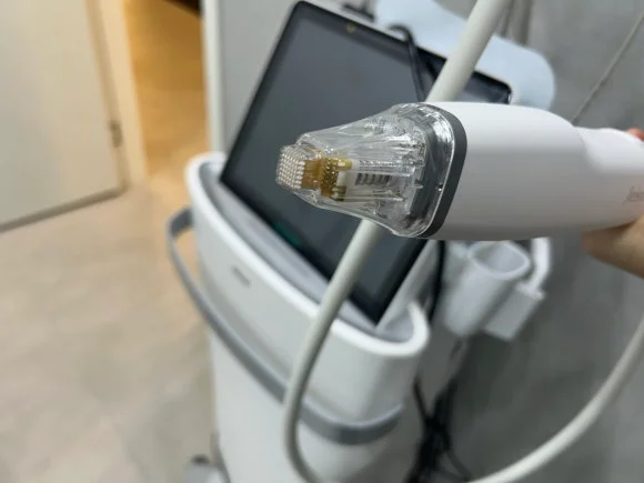 포텐자 후 모공·흉터 변화가 적을 때 원인 판단·깊이 설정·흉터 형태 점검