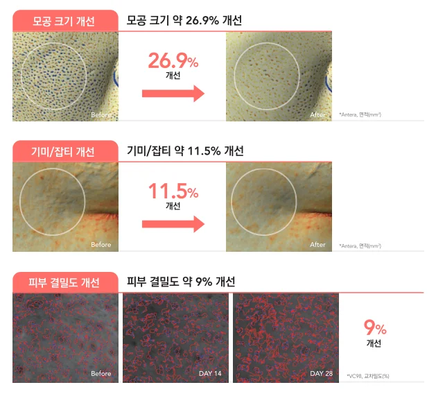 리투오 효과, 리투오 스킨부스터, 리투오 효과 시기, 리투오 효과 언제부터, 리투오 유지기간, 리투오 유지력, 리투오 후기, 리투오 전후, 리투오 피부 변화, 리투오 피부결 개선, 리투오 탄력 개선, 리투오 수분 관리, 리투오 광채 피부, 리투오 피부 재생, 리투오 피부 컨디션 개선, 리투오 몇 번, 리투오 1회 효과, 리투오 3회 효과, 리투오 권장 횟수, 리투오 시술 주기, 리투오 관리 주기, 리투오 파인, 리투오 파인 효과, 리투오 파인 후기, 리투오 파인 시술, 리투오 리투오파인 차이, 리투오 vs 리투오 파인, 리투오 아픈가요, 리투오 부작용, 리투오 엠보싱, 리투오 회복기간, 리투오 추천 대상, 스킨부스터 추천, 피부결 개선 시술, 피부 탄력 시술, 피부 광채 관리, 피부 수분 관리, 안티에이징 시술, 피부 노화 관리, 피부 재생 시술, 피부 탄력 관리, 피부과 스킨부스터, 스킨부스터 효과, 스킨부스터 유지기간, 스킨부스터 후기, 피부과 시술 추천, 자연스러운 피부 개선, 피부 컨디션 회복, 잔주름 개선, 피부 밀도 개선, 피부 속보습, 피부 광채 효과, 피부 탄력 회복, 동안 피부 관리, 피부 개선 프로그램, 피부 관리 시술, 리쥬버네이션 시술, 프리미엄 스킨부스터, 피부 장벽 개선, 건강한 피부 관리, 피부 수분 충전, 피부 탄력 케어, 피부결 관리, 피부톤 개선, 피부 속탄력, 피부 노화 예방, 맞춤형 피부 관리, 리투오 효과 후기, 리투오 실제 효과, 리투오 시술 효과, 리투오 스킨부스터 후기, 리투오 스킨부스터 효과, 리투오 스킨부스터 유지기간, 리투오 스킨부스터 권장 횟수, 리투오 스킨부스터 통증, 리투오 스킨부스터 부작용, 리투오 스킨부스터 전후, 리투오 스킨부스터 추천 대상