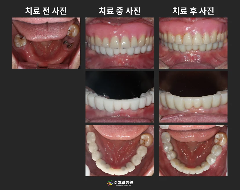 📸 치료 전후 비교 사진