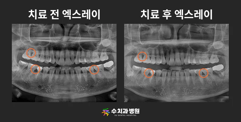 📸 치료 전후 비교 사진