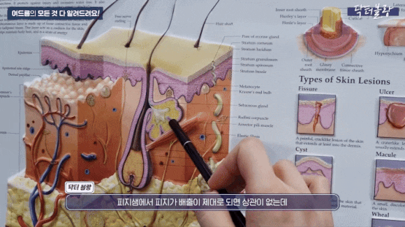 아쿠아필 3단계 수분 공급 및 진정 관리 장면