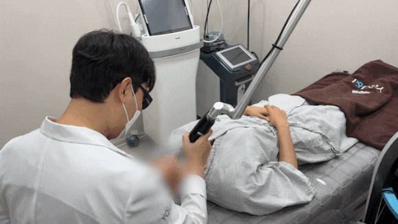 피코토닝 시술에 사용되는 피코슈어 레이저 장비